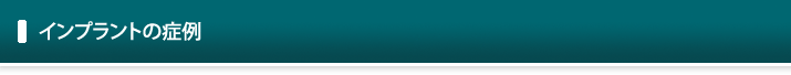 インプラントの症例