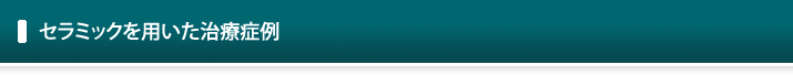セラミックを用いた治療症例